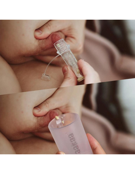 Kolostrum Sammler (vorsterilisiert) 6er Set